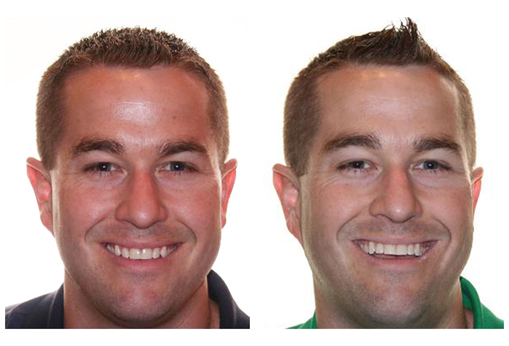 Maarten Broess DDS, DMSc, DMD, PC