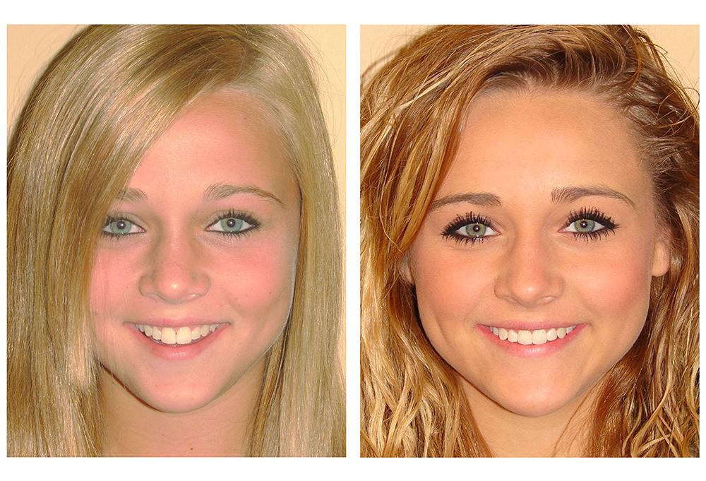 Maarten Broess DDS, DMSc, DMD, PC